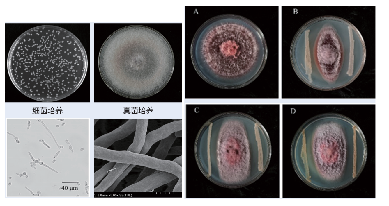 微生物案例，20260526173054.png